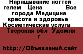 Наращивание ногтей гелем › Цена ­ 1 500 - Все города Медицина, красота и здоровье » Косметические услуги   . Тверская обл.,Удомля г.
